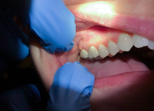 Best Emergency Dental Care for Trauma or Injury in Lake View, AL